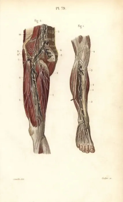 Framed Print : Lymph nodes and vessels deep in the leg Framed Print : Lymph nodes and vessels deep in the leg