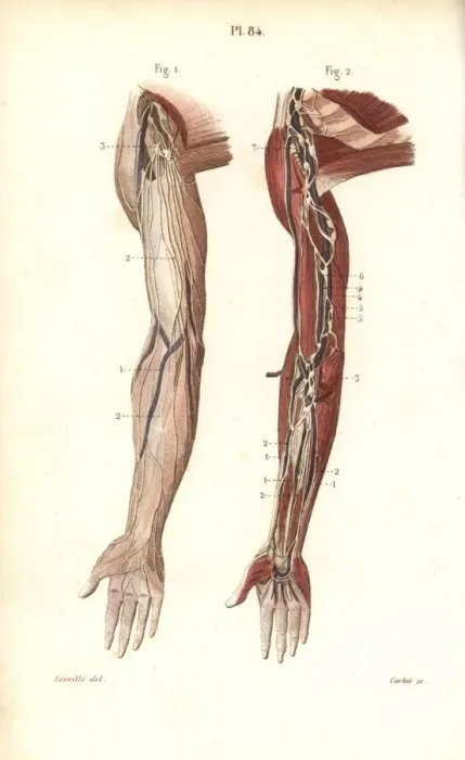 Framed Print : Lymphatic system in the arm Framed Print : Lymphatic system in the arm