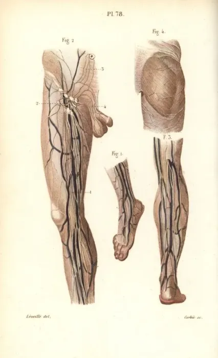Framed Print : Lymphatic system in the leg and foot Framed Print : Lymphatic system in the leg and foot