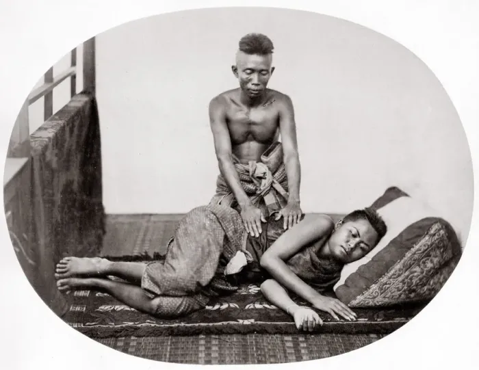 Framed Print : Masseur and massage, probably Siam, Thailand