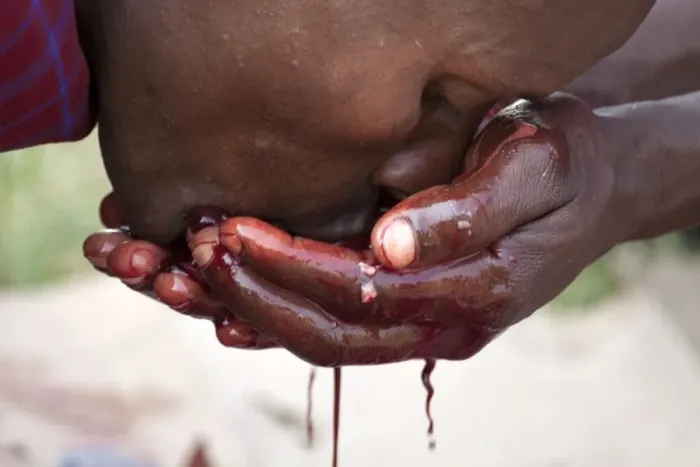 Framed Print : Msai Tribesman - drinking Goats blood during Framed Print : Msai Tribesman - drinking Goats blood during