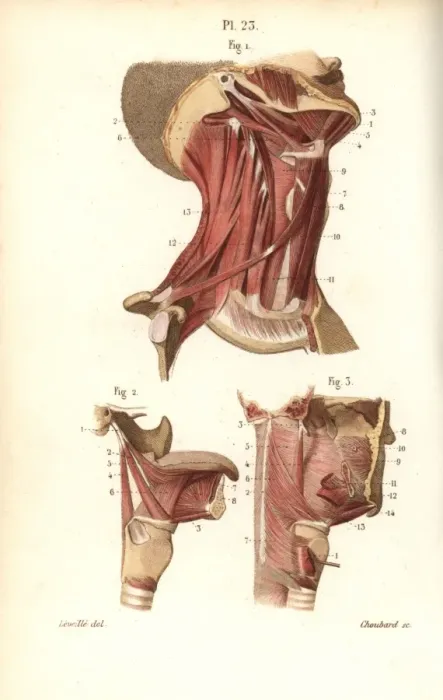 Framed Print : Muscles of the neck, tongue and throat Framed Print : Muscles of the neck, tongue and throat