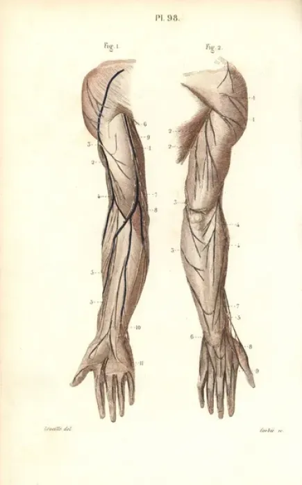 Framed Print : Nerves to the arm and hand Framed Print : Nerves to the arm and hand