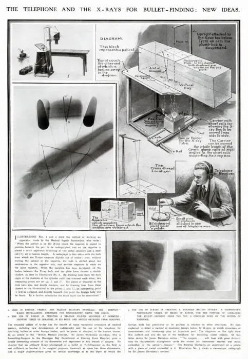 Framed Print : New Ideas for using X-Rays for Medical use WWI Framed Print : New Ideas for using X-Rays for Medical use WWI
