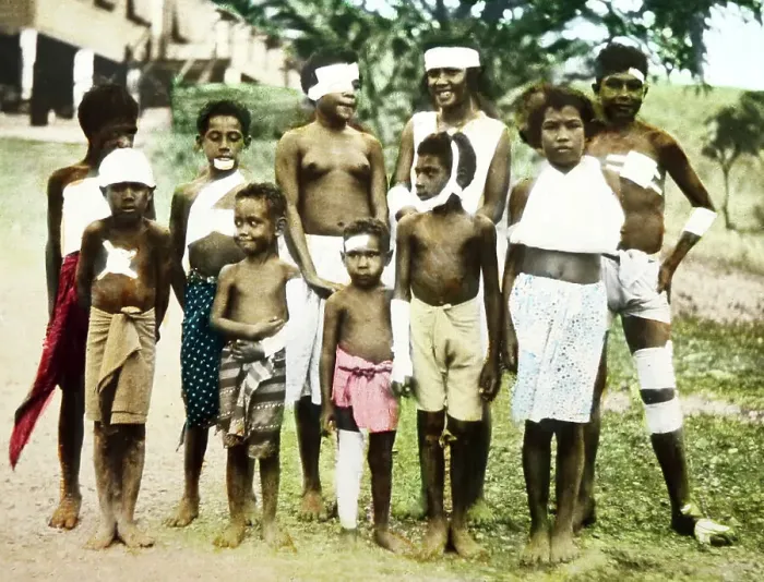 Framed Print : Patients at a Mission Hospital, Port Moresby, PNG Framed Print : Patients at a Mission Hospital, Port Moresby, PNG