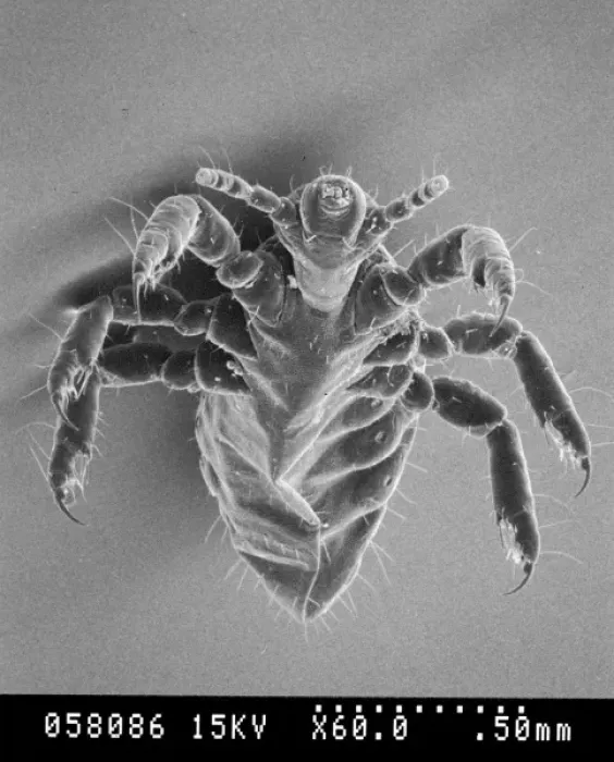 Framed Print : Pediculus humanus, human head louse Framed Print : Pediculus humanus, human head louse