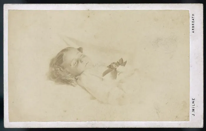 Framed Print : PHOTO OF DEAD 3 YR OLD