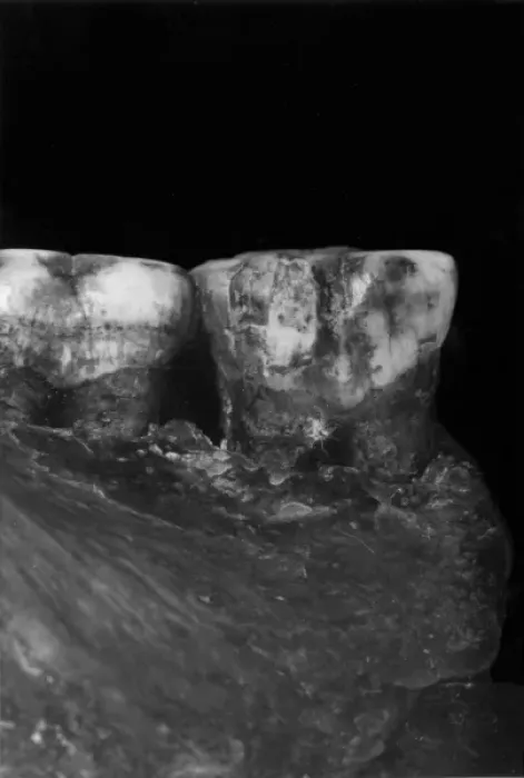 Framed Print : Piltdown 1 molars Framed Print : Piltdown 1 molars