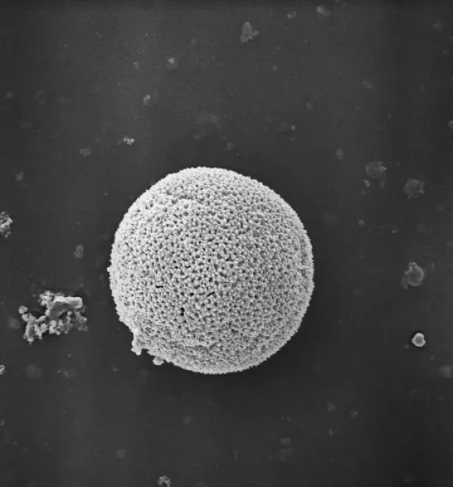 Framed Print : Populus nigra, lombardy or black poplar pollen (x 1500) Framed Print : Populus nigra, lombardy or black poplar pollen (x 1500)
