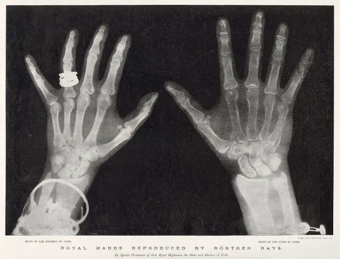 Framed Print : Royal Hands Reproduced by Rontgen Rays Framed Print : Royal Hands Reproduced by Rontgen Rays