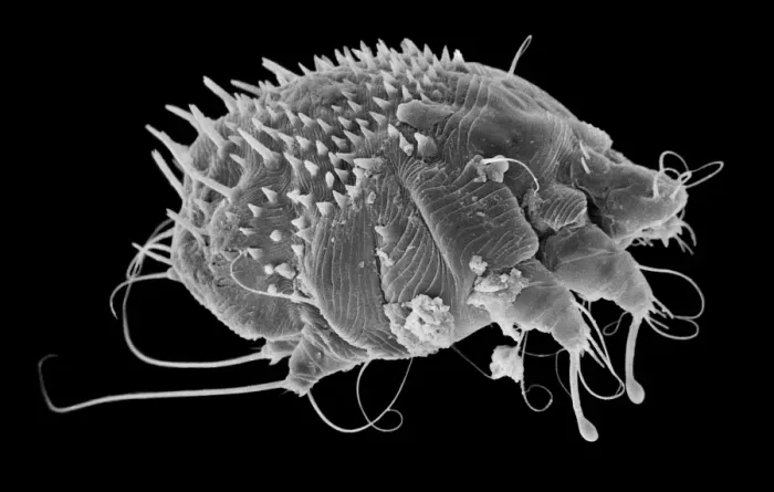 Framed Print : Sarcoptes scabiei, scabies mite Framed Print : Sarcoptes scabiei, scabies mite