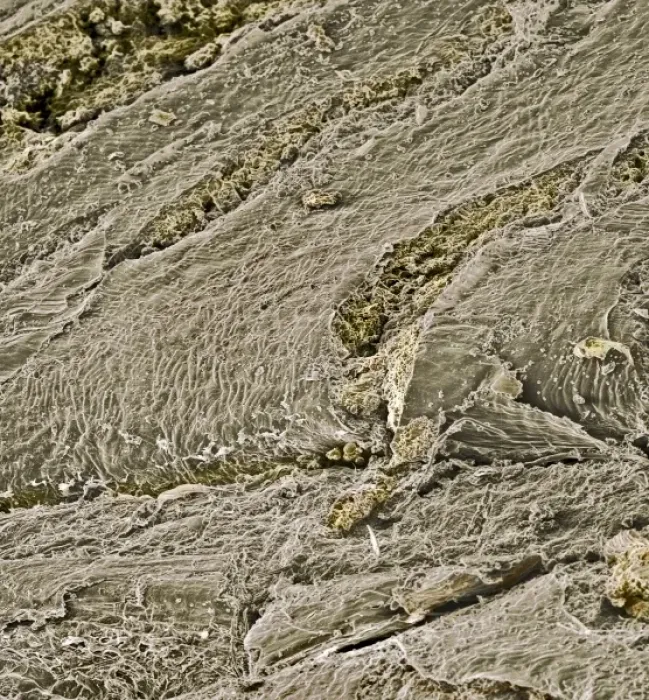 Framed Print : Oats. A scanning electron microscope (SEM) image of oats Framed Print : Oats. A scanning electron microscope (SEM) image of oats