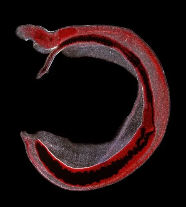 Framed Print : Schistosoma spp. blood fluke Framed Print : Schistosoma spp. blood fluke