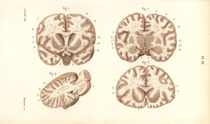 Framed Print : Sections through the brain Framed Print : Sections through the brain