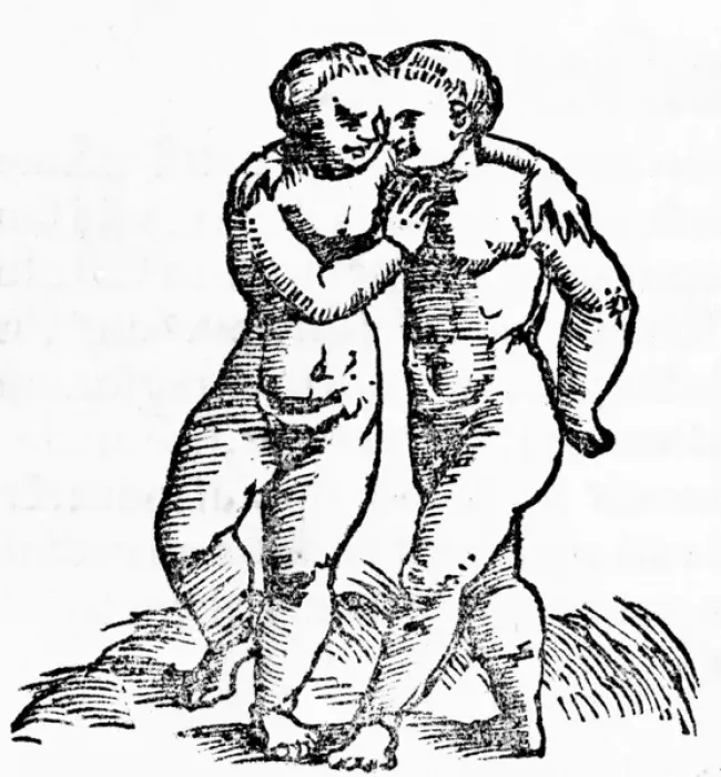 Framed Print : Siamese Twins / Munster Framed Print : Siamese Twins / Munster