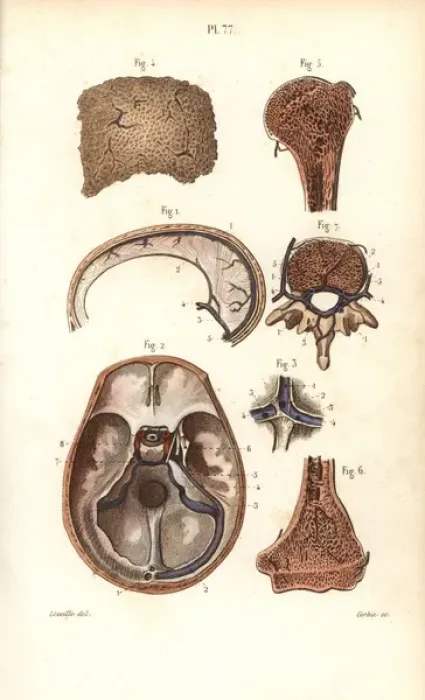 Framed Print : Sinuses or cavities in skull, humerus and vertebrae Framed Print : Sinuses or cavities in skull, humerus and vertebrae
