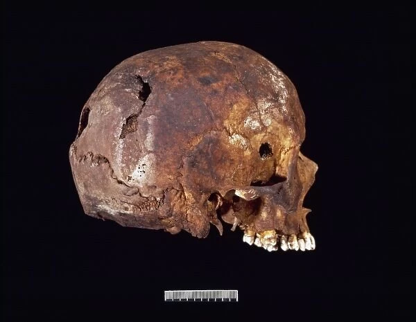 Skull showing bullet hole in right temple