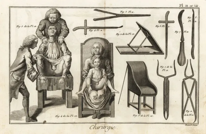 Framed Print : Surgical chairs and instruments for a bladder Framed Print : Surgical chairs and instruments for a bladder