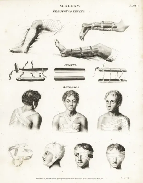Framed Print : Surgical procedures from the 19th century Framed Print : Surgical procedures from the 19th century