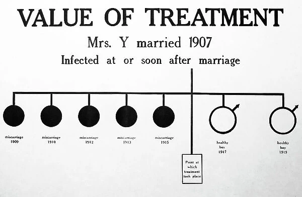 Syphilis treatment, 1920s projection slide