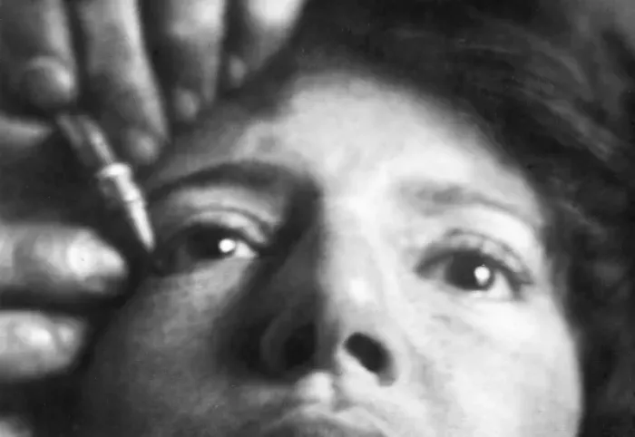 Framed Print : Tattooing an Eyelid Framed Print : Tattooing an Eyelid