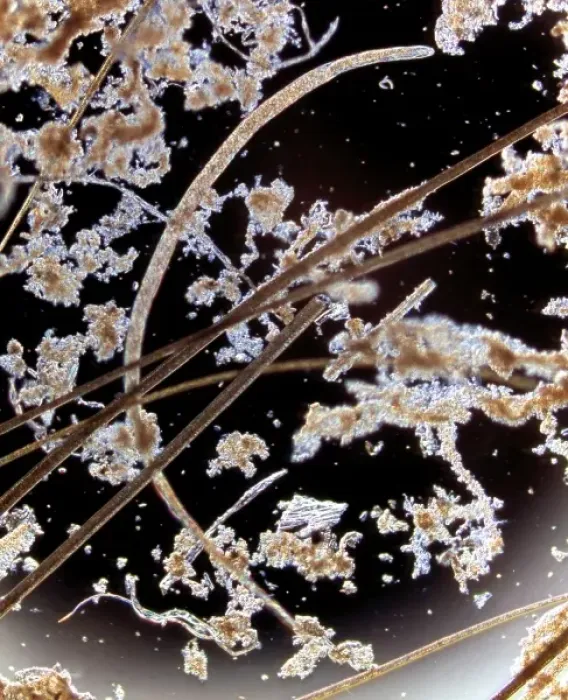 Framed Print : Trichinella spiralis, parasitic roundworm