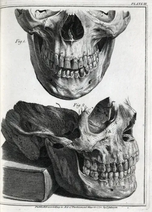 Framed Print : Upper and lower human jaws Framed Print : Upper and lower human jaws