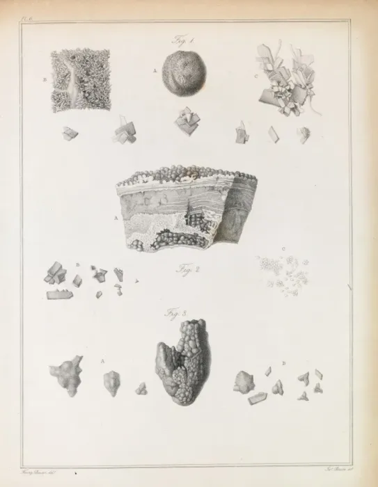 Framed Print : Urinary stones Framed Print : Urinary stones
