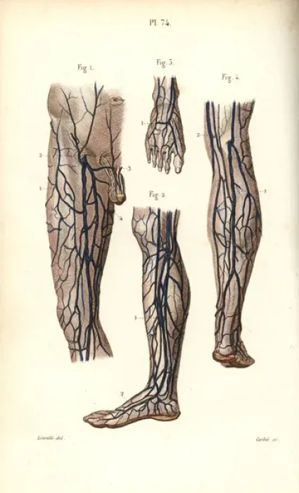 Framed Print : Veins to the leg and foot Framed Print : Veins to the leg and foot