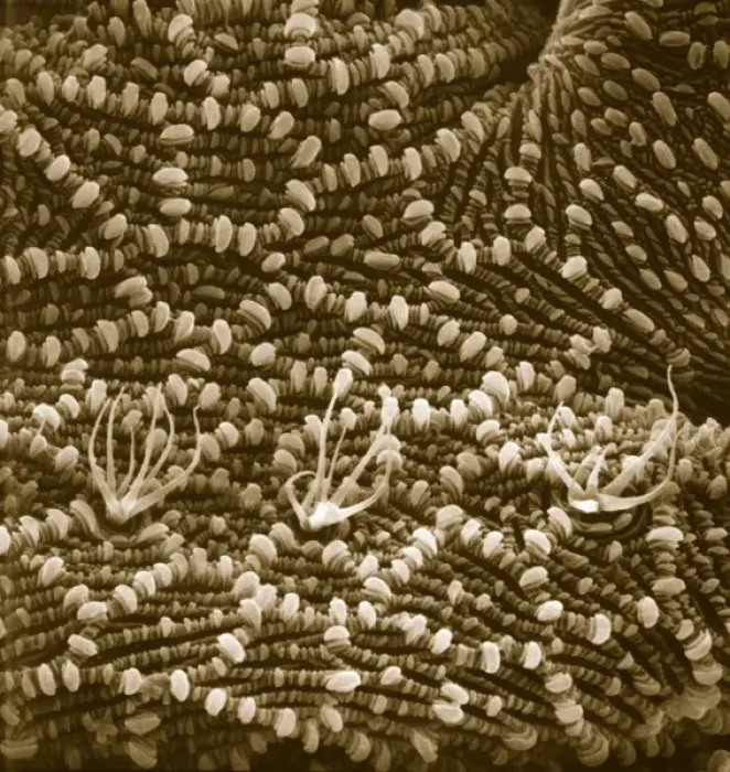 Framed Print : Ventral surface of a mite from the prostigmatic species Framed Print : Ventral surface of a mite from the prostigmatic species