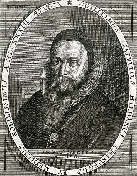 Wilhelm Fabricius. WILHELM FABRICIUS German surgeon Date: 1580 - 1634