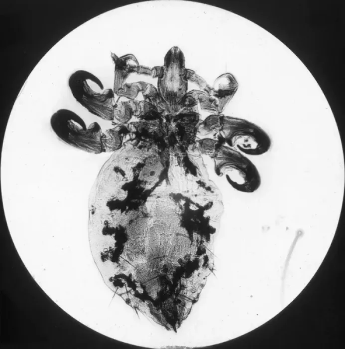 Framed Print : X-Ray - Antelope Parasite Framed Print : X-Ray - Antelope Parasite