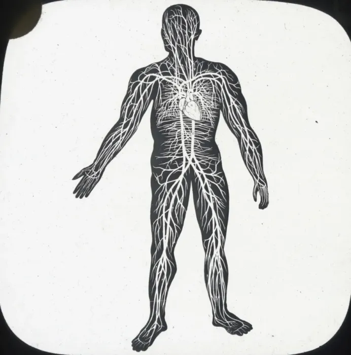 Framed Print : X-Ray - Circulatory System of Human Framed Print : X-Ray - Circulatory System of Human