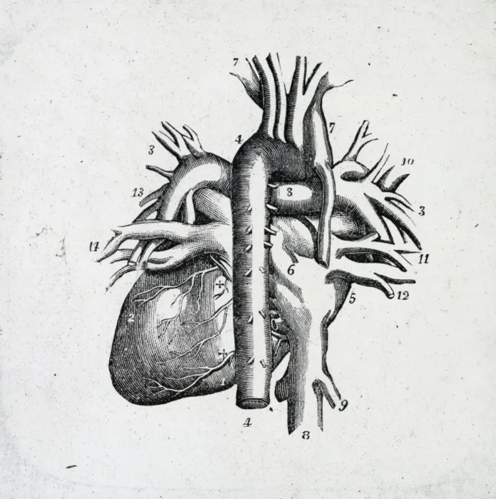 Framed Print : X-Ray - Heart and Vessels Framed Print : X-Ray - Heart and Vessels