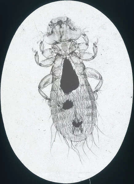 X-Ray - Microscopic x-ray view of a small head louse