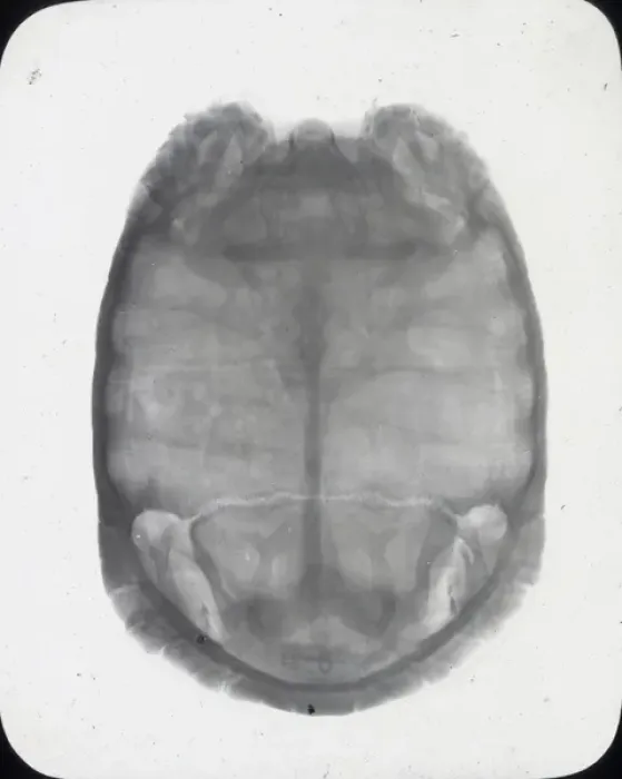Framed Print : X-Ray - Showing Skeleton of Tortoise Framed Print : X-Ray - Showing Skeleton of Tortoise