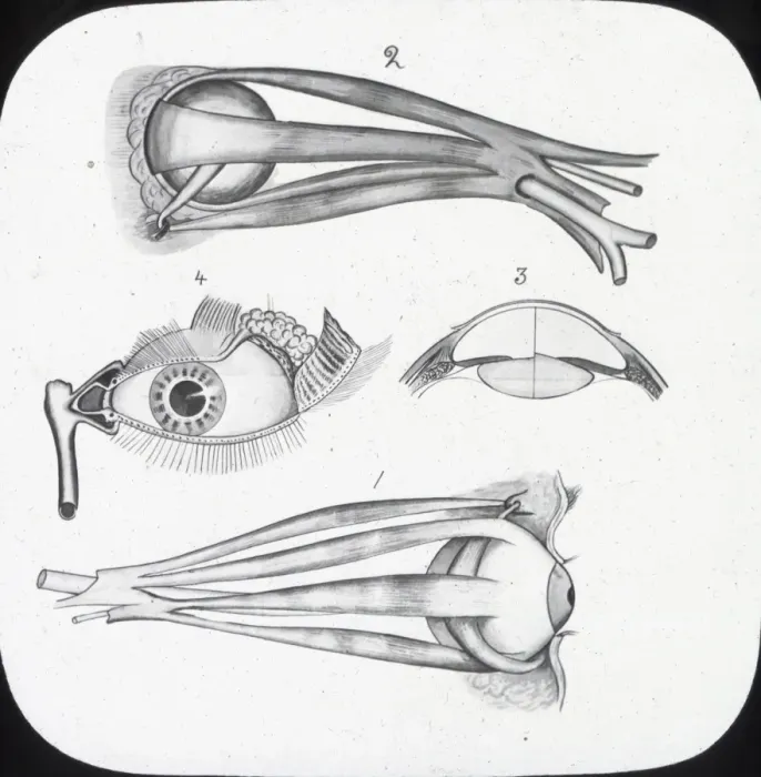 Framed Print : X-Ray - Sight - muscles of eye and Lachmymal apparatus Framed Print : X-Ray - Sight - muscles of eye and Lachmymal apparatus