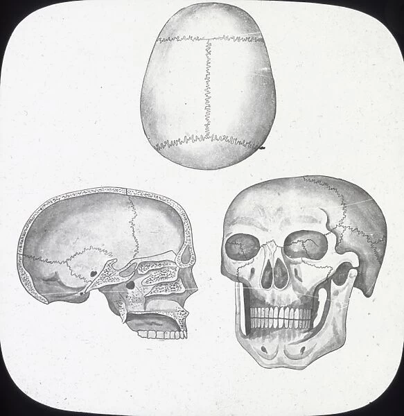 X-Ray - Skull, Front, Top-and Section