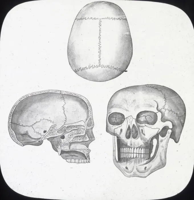 Framed Print : X-Ray - Skull, Front, Top-and Section Framed Print : X-Ray - Skull, Front, Top-and Section