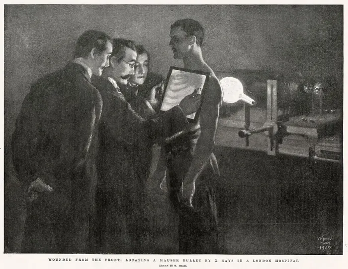 Framed Print : X-ray - Soldier with Bullet Bound Being Examined 1900 Framed Print : X-ray - Soldier with Bullet Bound Being Examined 1900
