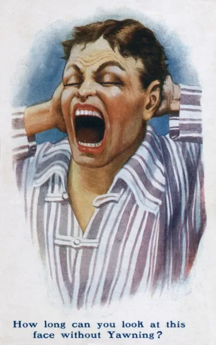 Framed Print : Yawning Man - waking up Framed Print : Yawning Man - waking up