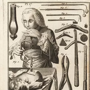 18th century surgeon performing a trepanning
