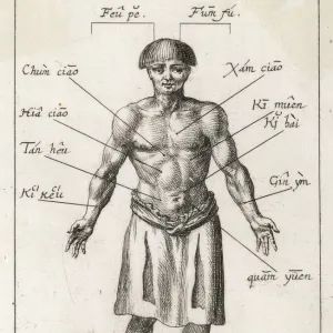 Acupuncture in 17th Cent