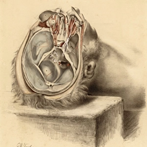 Anatomy / Base of Skull