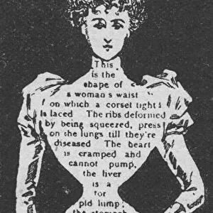 Annotated illustration warning about the dangers of tight laced corsets on the female