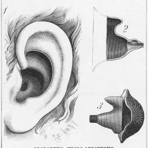 Blodgetts Hearing Aid