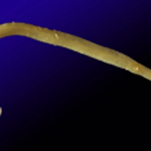 Capillaria philippinensis, parasitic worm