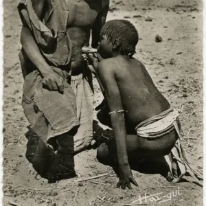 Chad - Cupping - Indigenous medicinal practise