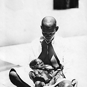 Child with Yaws, Mombasa, Kenya, East Africa