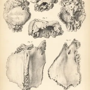 Cranium and sternum of the extinct Rodrigues